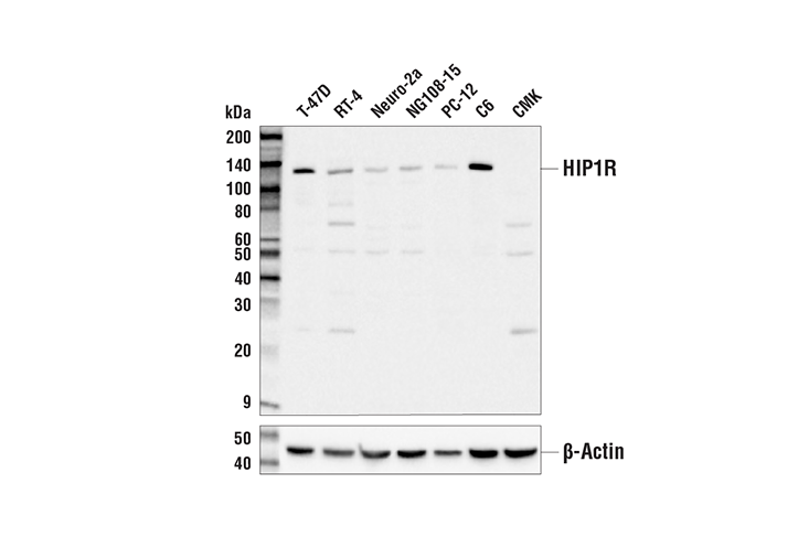 Western Blotting Image 1: HIP1R Antibody