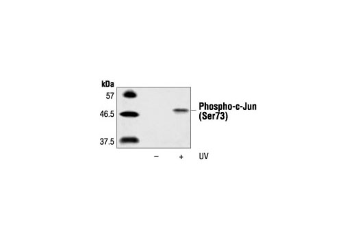 Western Blotting Image 1: Phospho-c-Jun (Ser73) Antibody