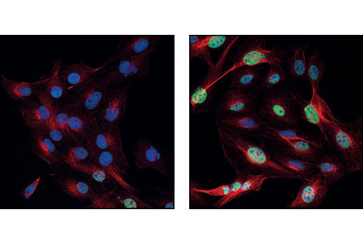 Immunofluorescence Image 1: Phospho-c-Jun (Ser73) Antibody
