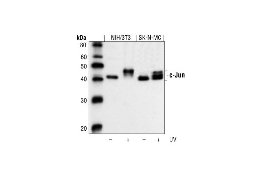  Image 17: Wnt/β-Catenin Activated Targets Antibody Sampler Kit