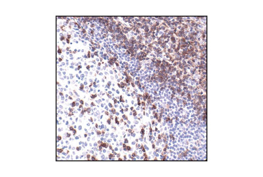  Image 16: T Cell Signaling Antibody Sampler Kit
