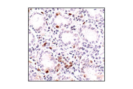 Immunohistochemistry Image 3: Phospho-Stat1 (Tyr701) (58D6) Rabbit mAb