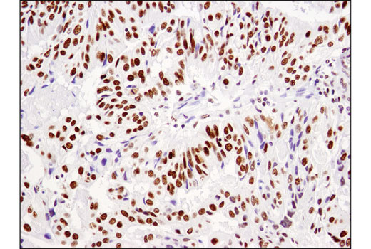 Image 46: BAF Complex IHC Antibody Sampler Kit