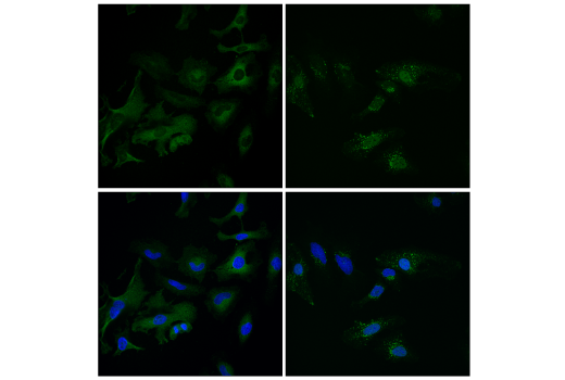 Immunofluorescence Image 1: TFEB (E4I8R) Mouse mAb