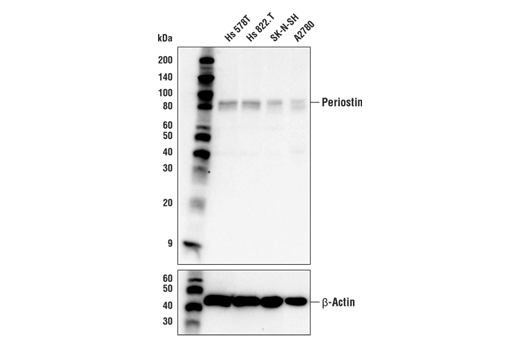 Western Blotting Image 1: Periostin Antibody
