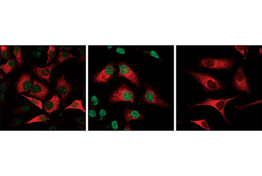Immunofluorescence Image 1: Phospho-Stat1 (Ser727) Antibody