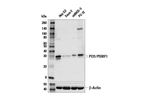 Western Blotting Image 1: PI31/PSMF1 Antibody