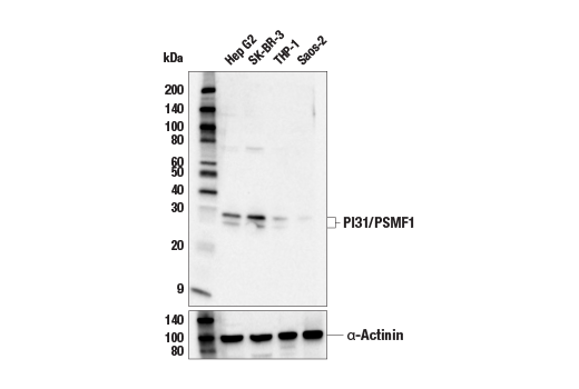 Western Blotting Image 2: PI31/PSMF1 Antibody