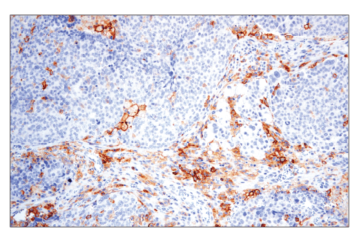 Immunohistochemistry Image 4: CD86 (E2G8P) Rabbit mAb