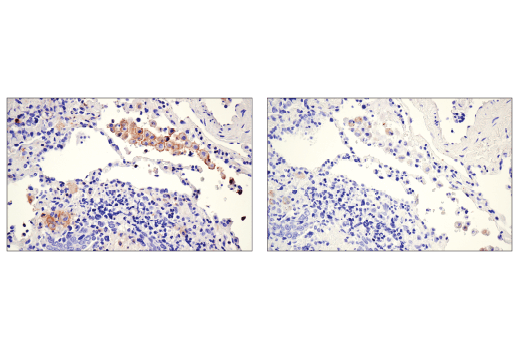  Image 50: Human Reactive M1 vs M2 Macrophage IHC Antibody Sampler Kit