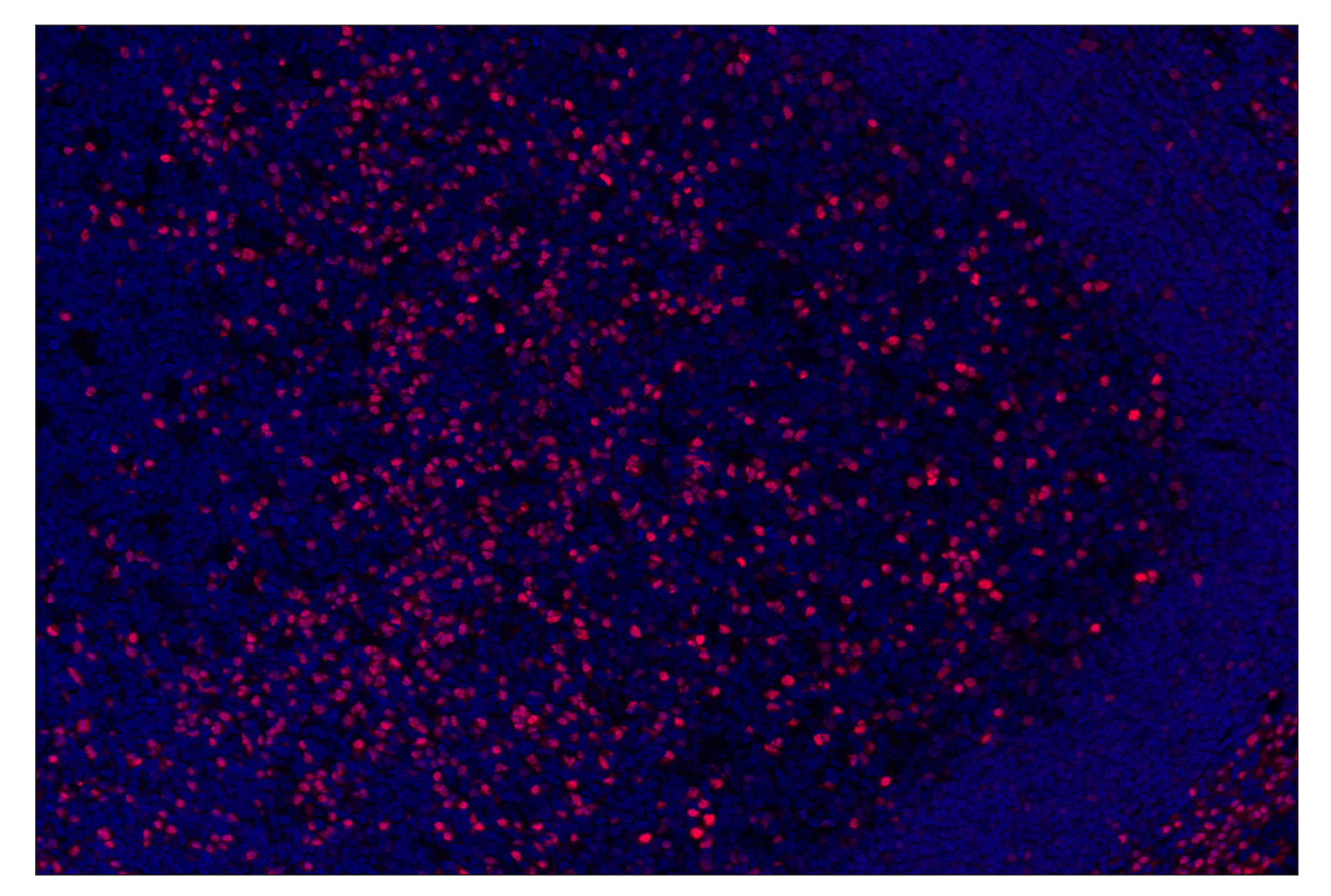 Immunohistochemistry Image 3: IRF-4 (E8H3S) & CO-0233-488 SignalStar<sup>®</sup> Oligo-Antibody Pair