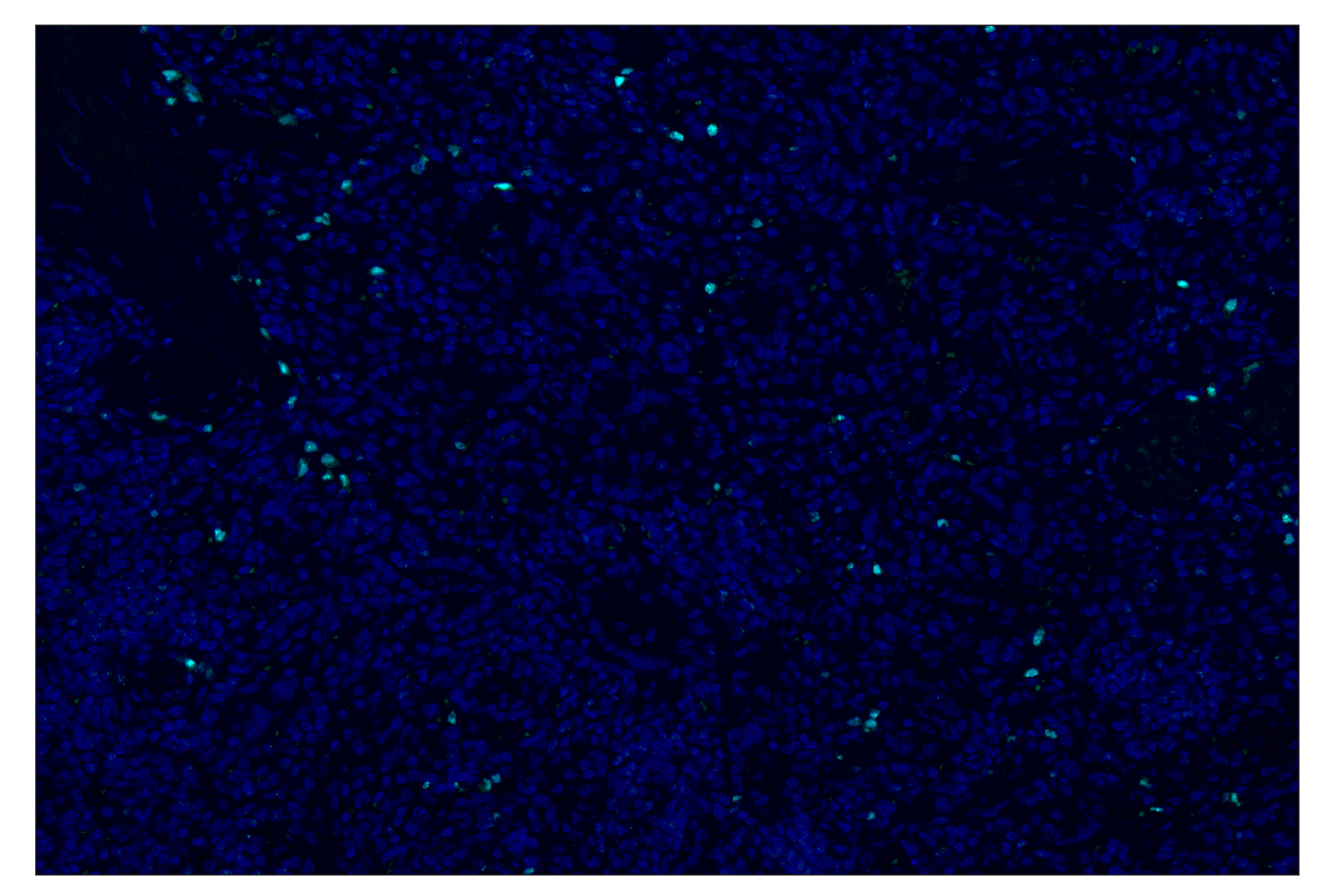 Immunohistochemistry Image 4: IRF-4 (E8H3S) & CO-0233-488 SignalStar<sup>®</sup> Oligo-Antibody Pair