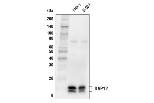 Western Blotting Image 1: DAP12 (D7G1X) Rabbit mAb (Biotinylated)