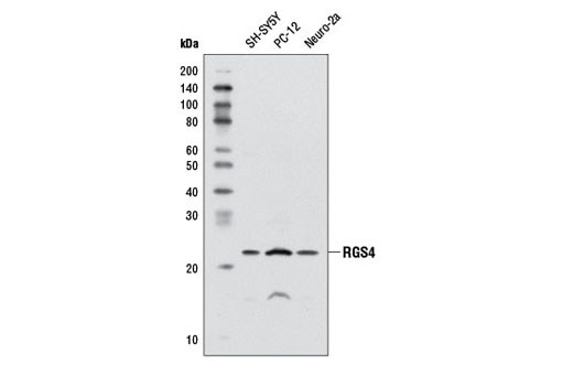 Western Blotting Image 1: RGS4 Antibody