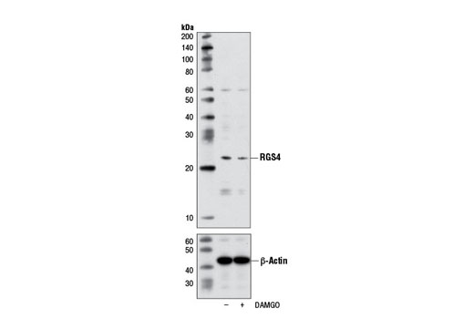 Western Blotting Image 2: RGS4 Antibody