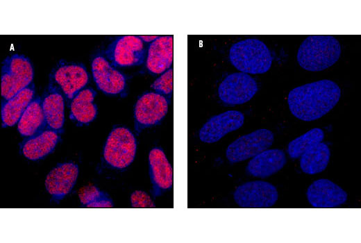 Immunofluorescence Image 2: CREB (48H2) Rabbit mAb