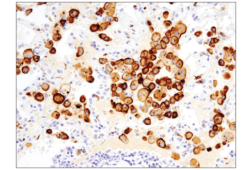 Immunohistochemistry Image 1: CD206/MRC1 (E2L9N) Rabbit mAb