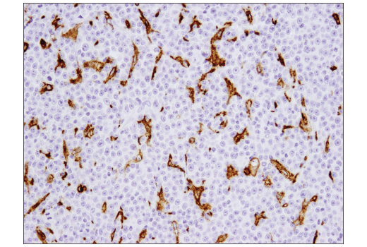 Immunohistochemistry Image 5: CD206/MRC1 (E2L9N) Rabbit mAb