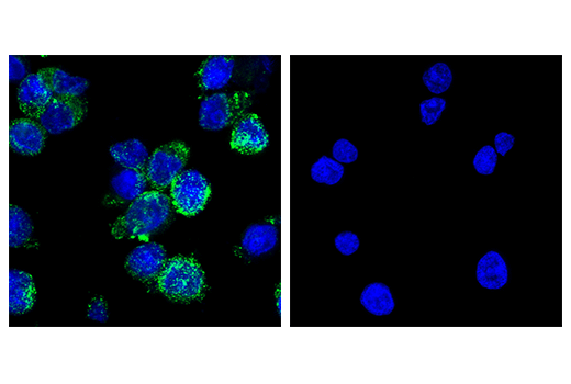 Immunofluorescence Image 1: CD206/MRC1 (E2L9N) Rabbit mAb