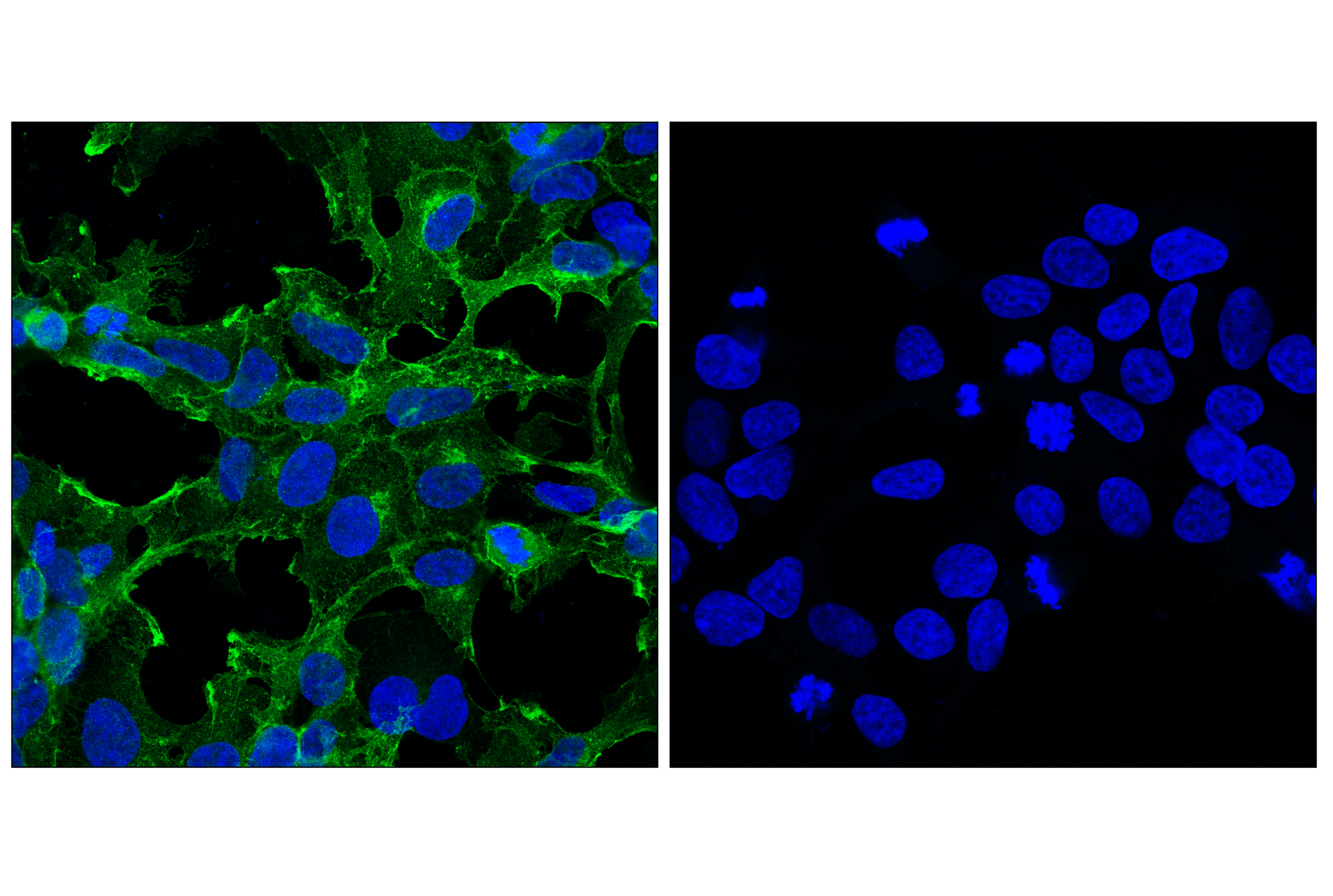 Immunofluorescence Image 1: Myc-Tag (E7F9B) Mouse mAb