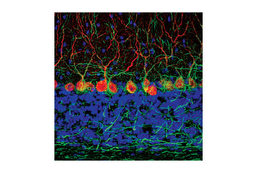 Immunofluorescence Image 1: Neurofilament-H (RMdO 20) Mouse mAb (BSA and Azide Free)