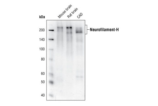 Western Blotting Image 1: Neurofilament-H (RMdO 20) Mouse mAb (BSA and Azide Free)