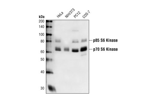 Western Blotting Image 1: p70 S6 Kinase Antibody