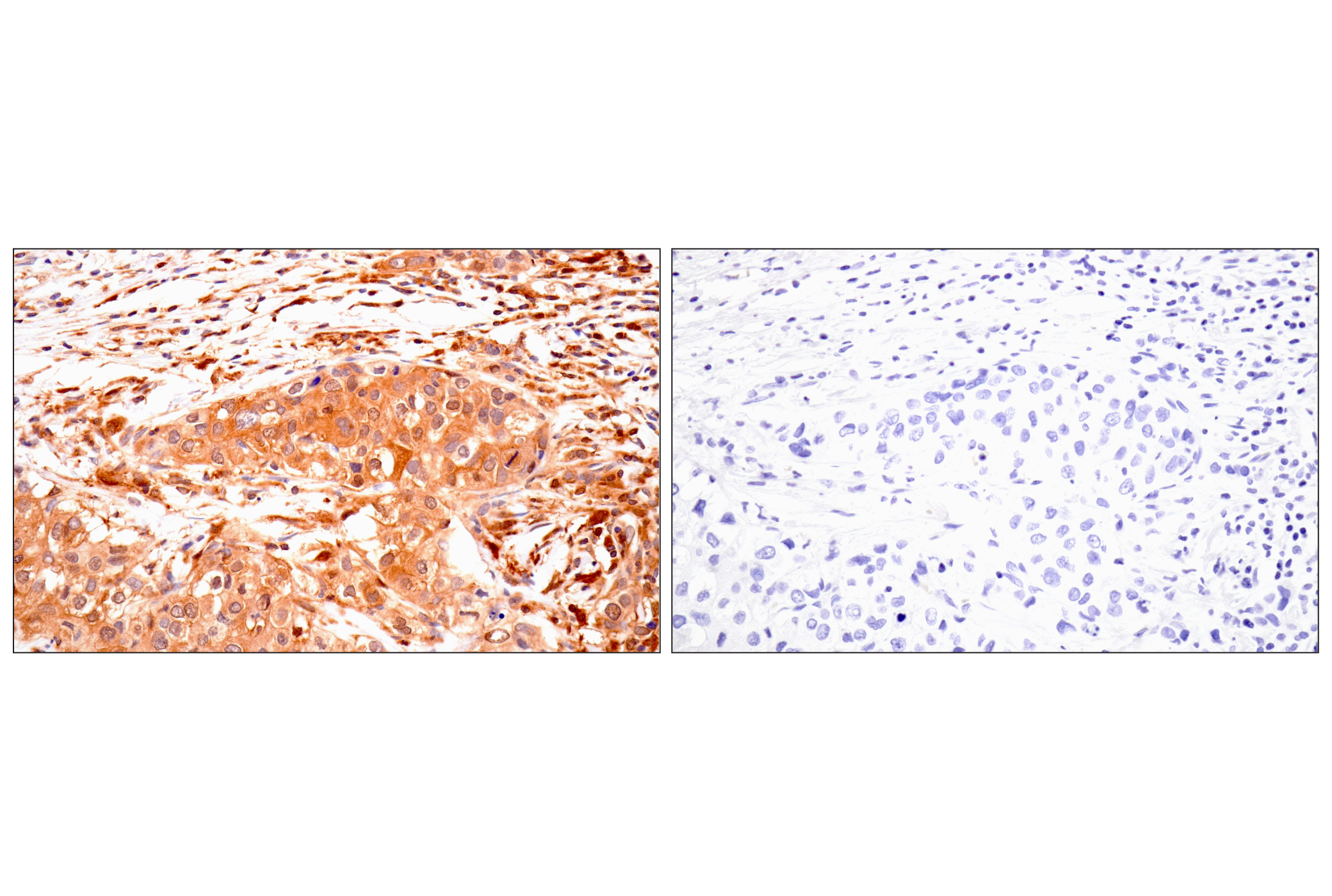 Immunohistochemistry Image 8: TRIM21 (D1O1D) Rabbit mAb