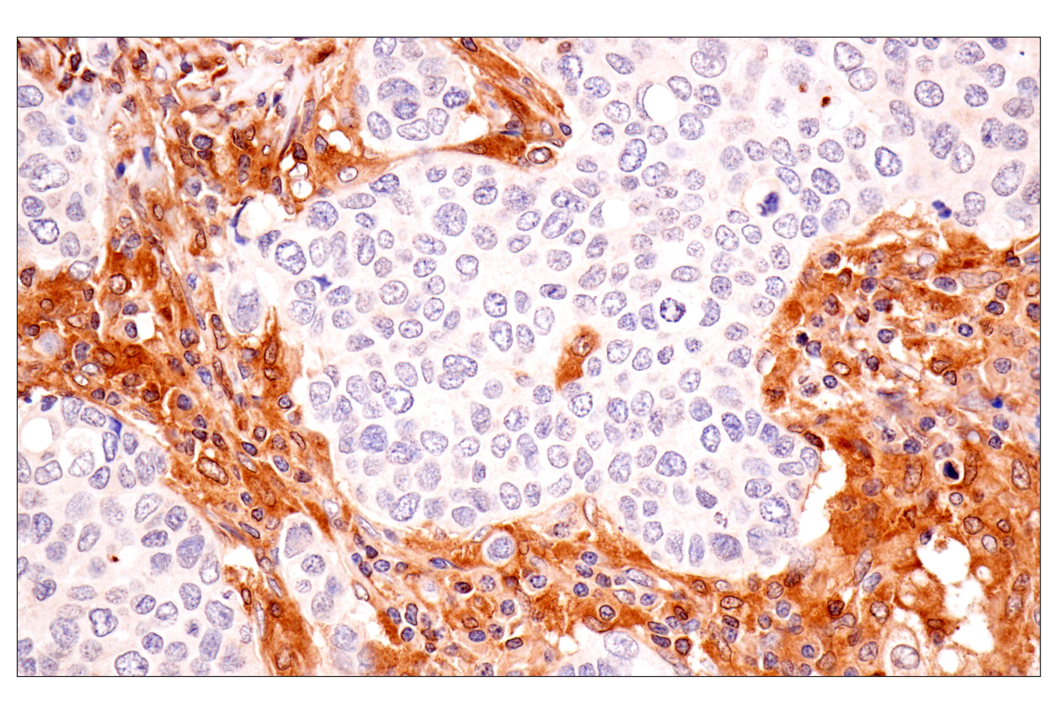 Immunohistochemistry Image 4: TRIM21 (D1O1D) Rabbit mAb