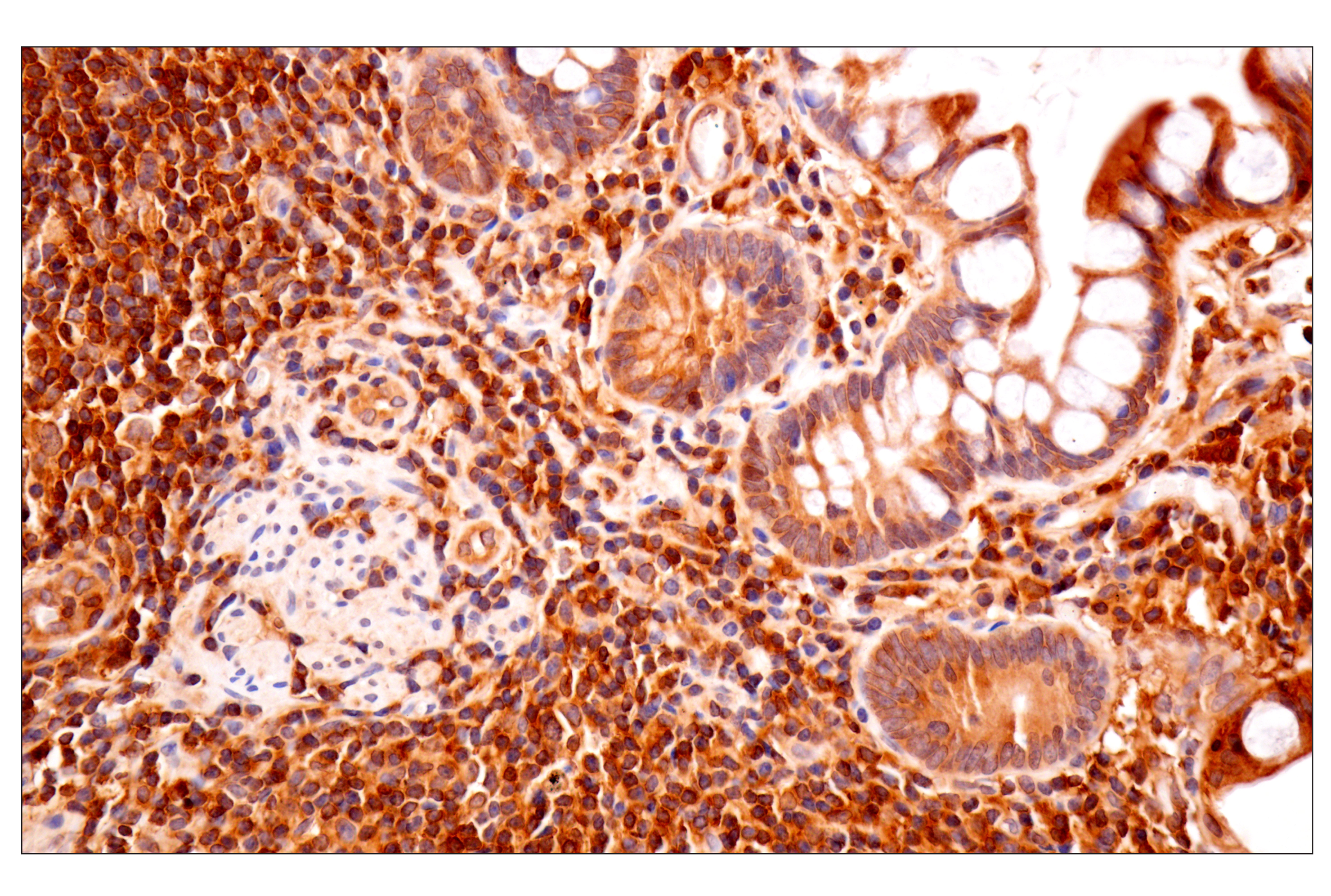 Immunohistochemistry Image 6: TRIM21 (D1O1D) Rabbit mAb