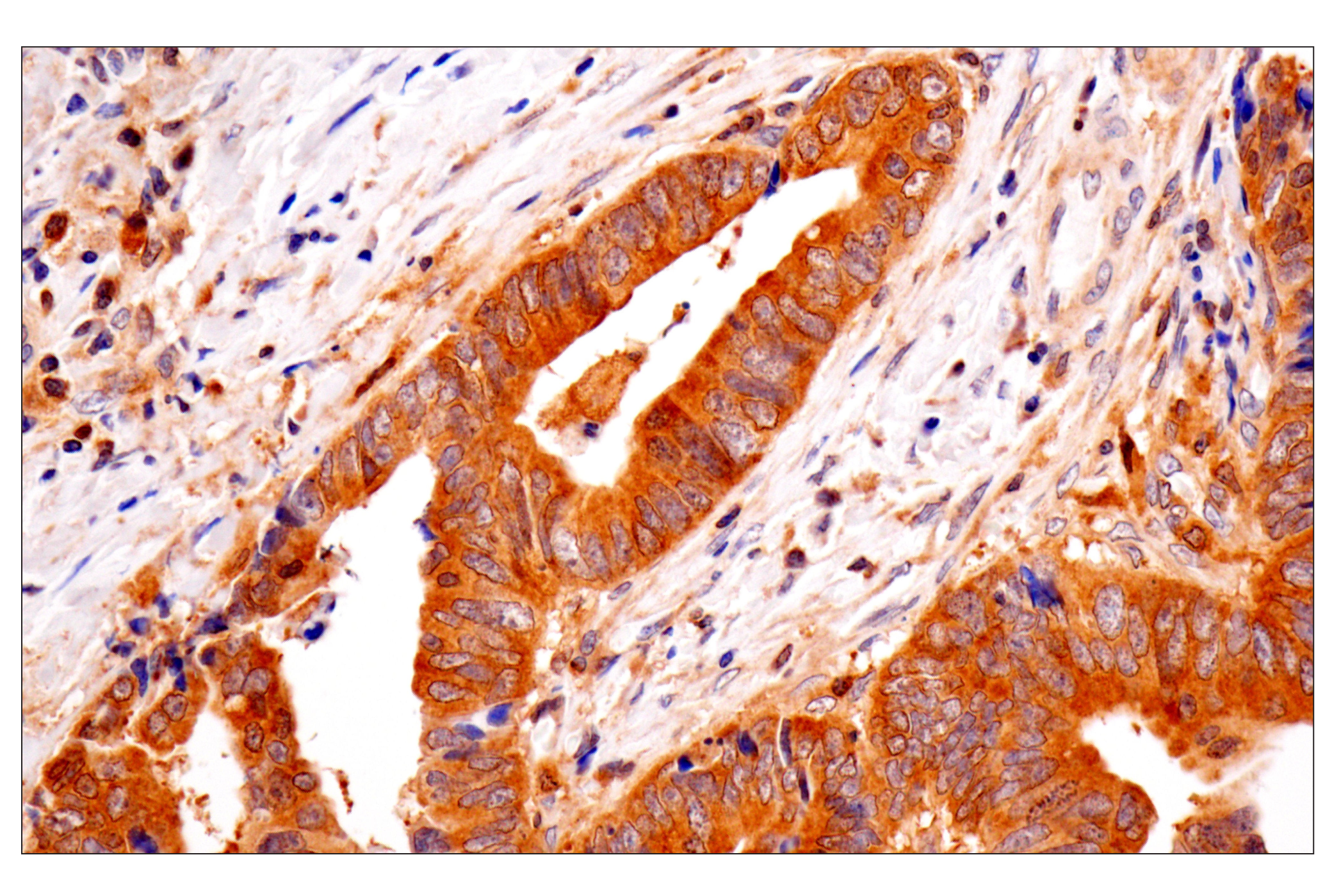 Immunohistochemistry Image 1: TRIM21 (D1O1D) Rabbit mAb