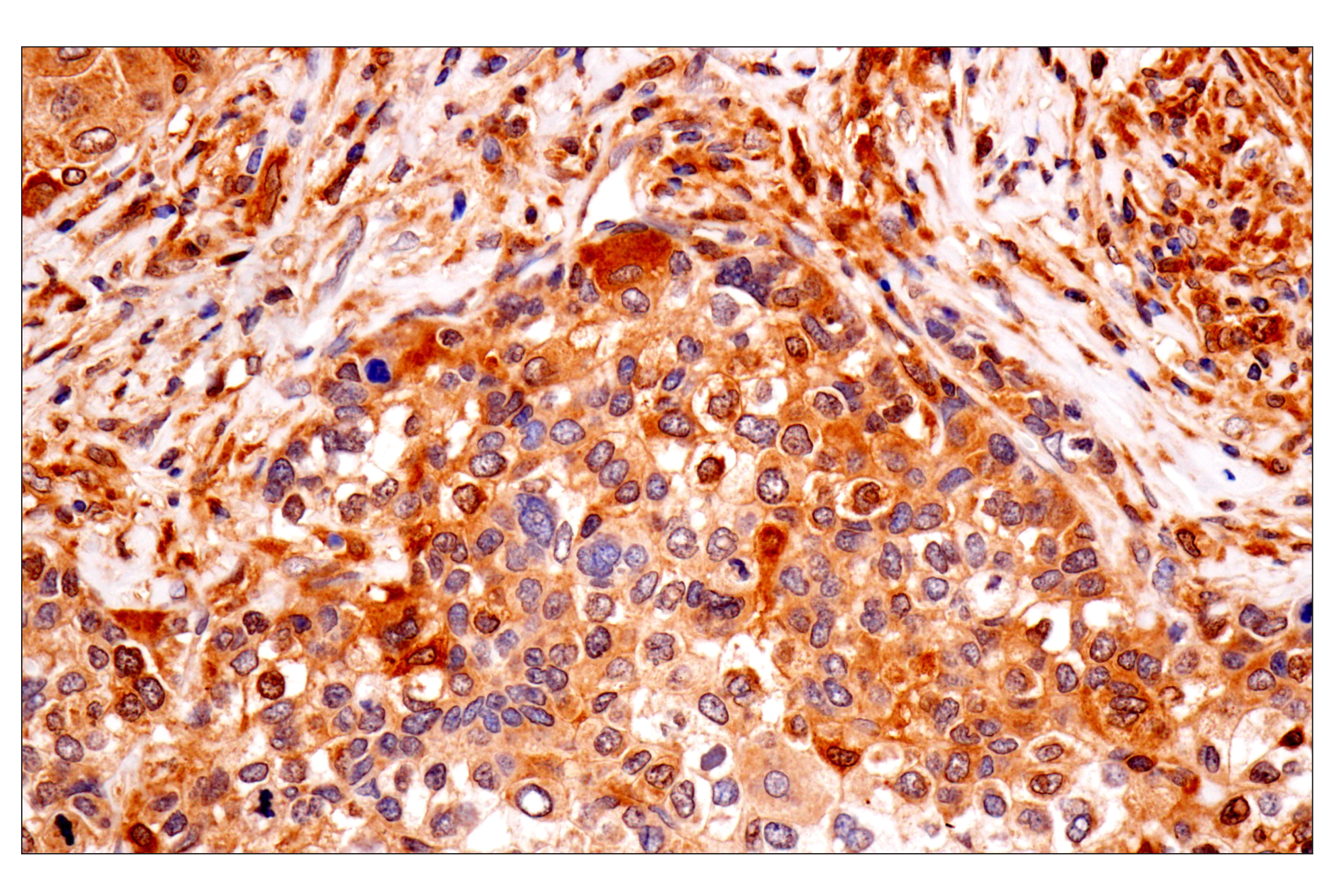 Immunohistochemistry Image 2: TRIM21 (D1O1D) Rabbit mAb