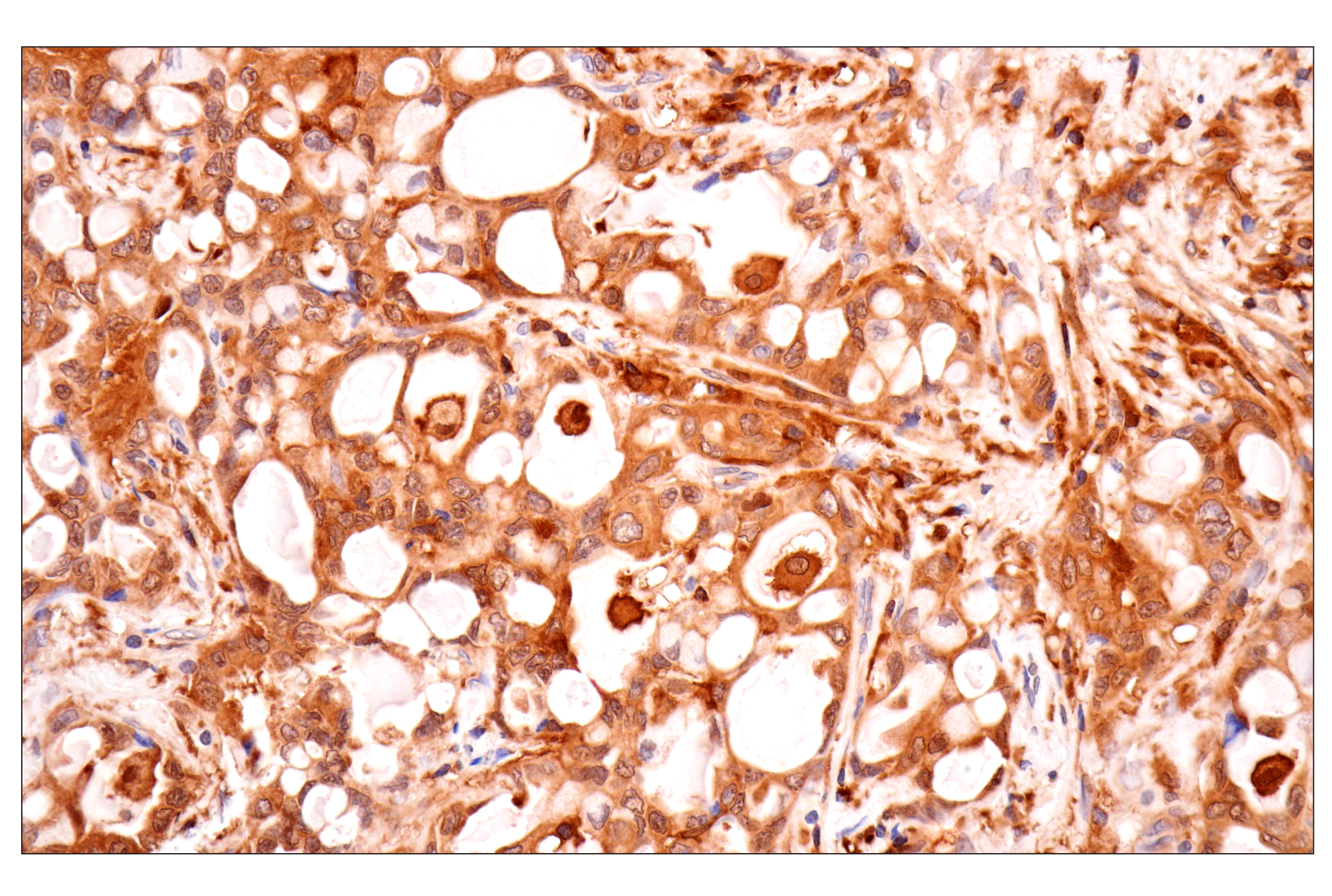 Immunohistochemistry Image 5: TRIM21 (D1O1D) Rabbit mAb