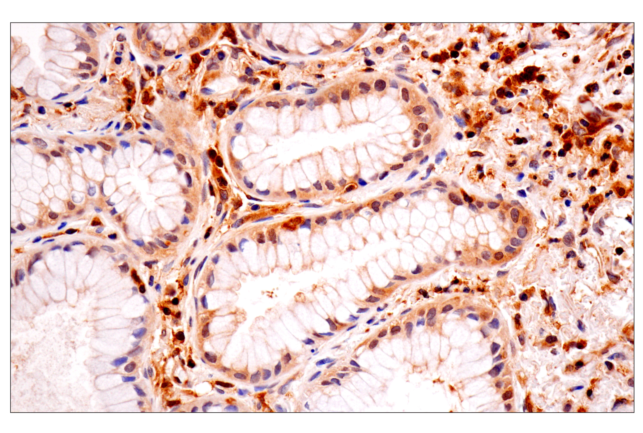 Immunohistochemistry Image 3: TRIM21 (D1O1D) Rabbit mAb