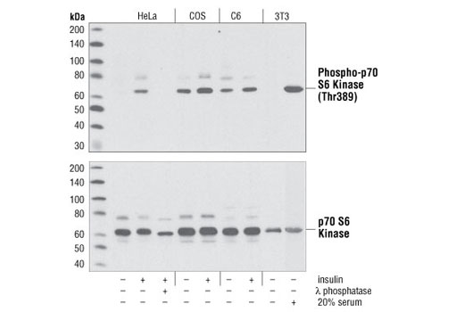 Western Blotting Image 1: Phospho-p70 S6 Kinase (Thr389) Antibody