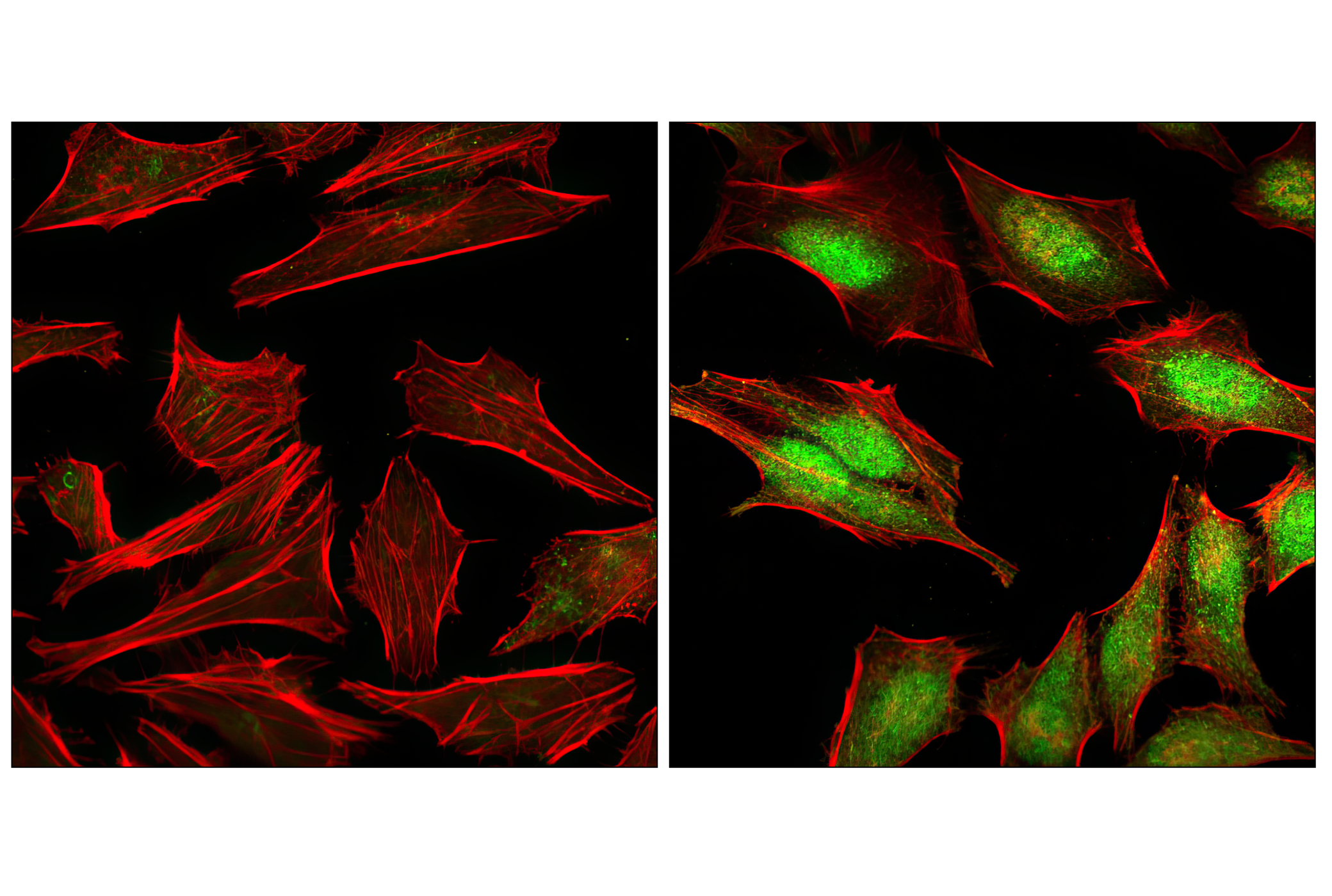 Immunofluorescence Image 1: Phospho-p38 MAPK (Thr180/Tyr182) Antibody