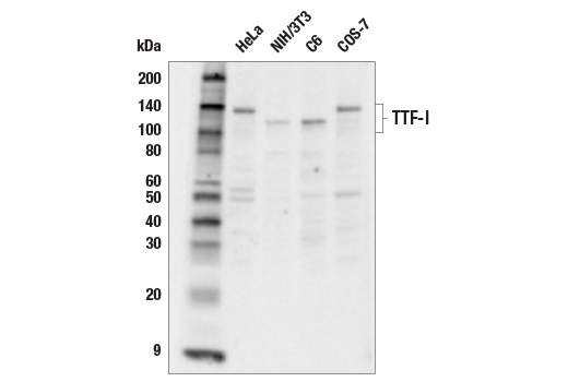 Western Blotting Image 1: TTF-I Antibody
