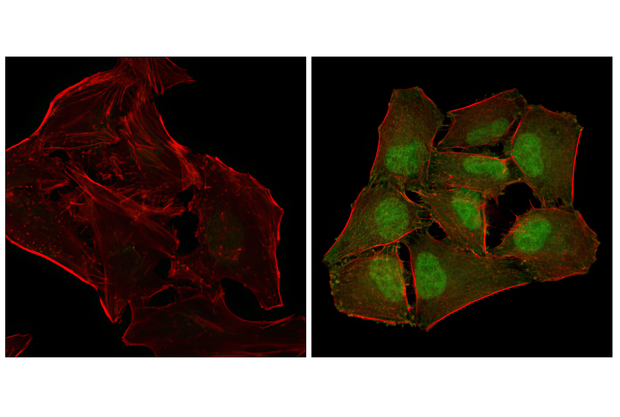 Immunofluorescence Image 1: Phospho-p38 MAPK (Thr180/Tyr182) (3D7) Rabbit mAb