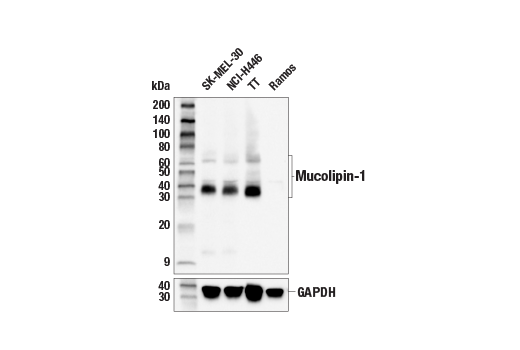 Western Blotting Image 1: Mucolipin-1 Antibody