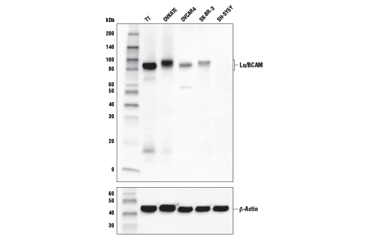 Western Blotting Image 1: Lu/BCAM Antibody