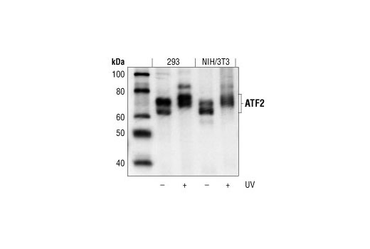  Image 2: PhosphoPlus® ATF-2 (Thr71) Antibody Duet