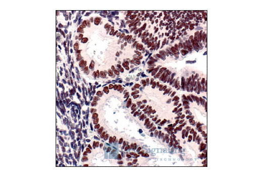 Immunohistochemistry Image 1: ATF-2 (20F1) Rabbit mAb