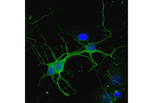 Immunofluorescence Image 2: CaMKII-α (6G9) Mouse mAb (BSA and Azide Free)