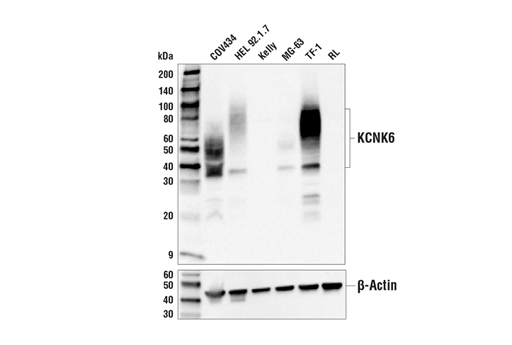 Western Blotting Image 1: KCNK6 Antibody
