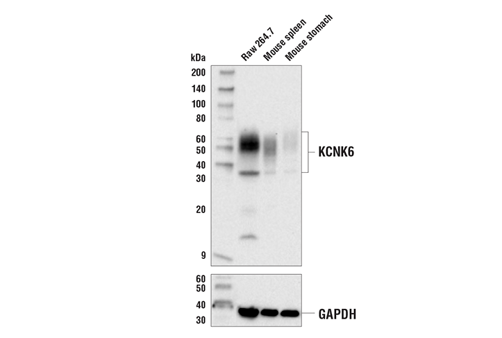 Western Blotting Image 2: KCNK6 Antibody