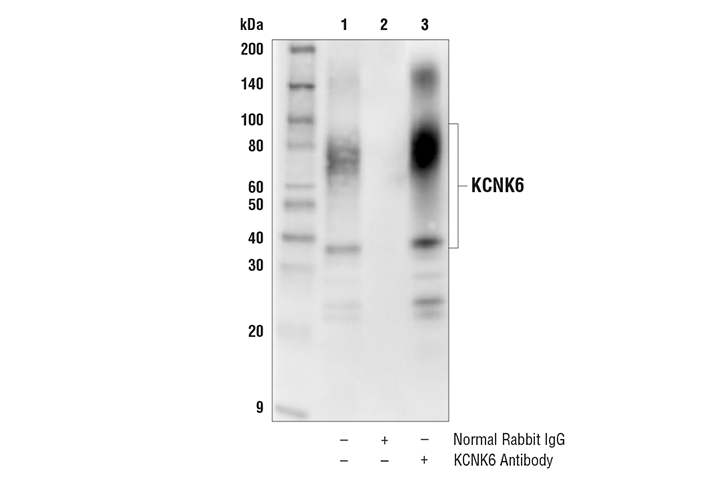 Immunoprecipitation Image 1: KCNK6 Antibody