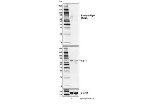  Image 5: PhosphoPlus® Atg14 (Ser29) Antibody Duet