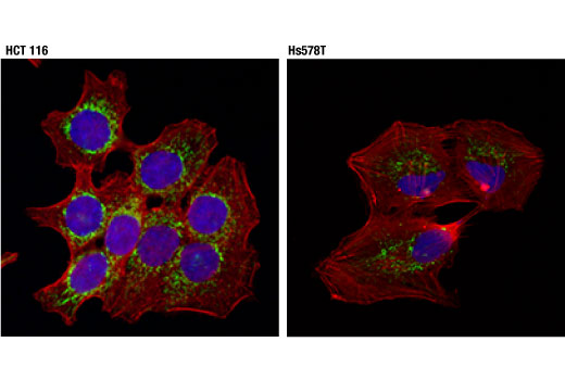Immunofluorescence Image 1: TRAP1/HSP75 (D3D7N) Rabbit mAb