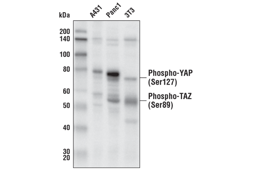 Western Blotting Image 4: Phospho-YAP (Ser127) (D9W2I) Rabbit mAb (BSA and Azide Free)