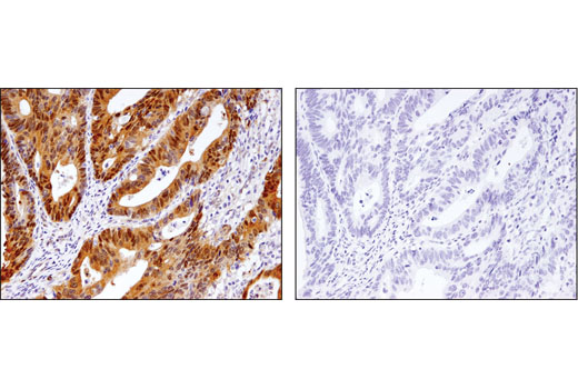 Immunohistochemistry Image 1: Phospho-YAP (Ser127) (D9W2I) Rabbit mAb (BSA and Azide Free)